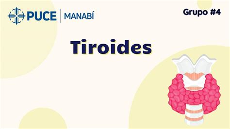 Tiroides pdf María José Wittong Moreira uDocz