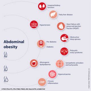 Main And Additional Conditions Of The Metabolic Syndrome As The