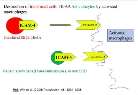 Figure 2 From Hyperhaemolysis Syndrome In Sickle Cell Disease