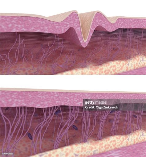 simile  collagen  elastin fibers  aging wrinkled  young