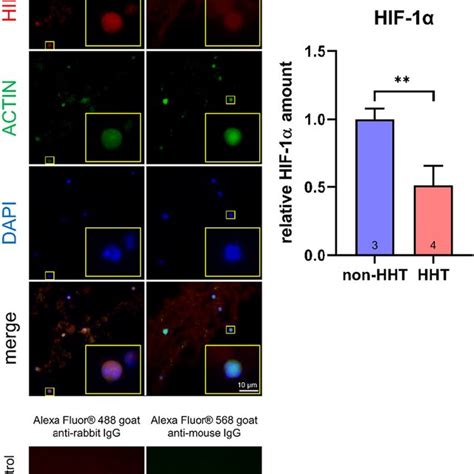 HIF 1α protein immunostaining in whole blood Whole blood of HHT