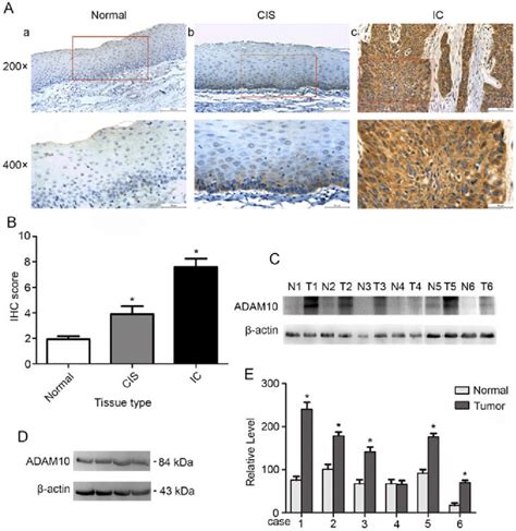 Expression Level Of Adam10 In Paracancerous And Hscc Tissues A