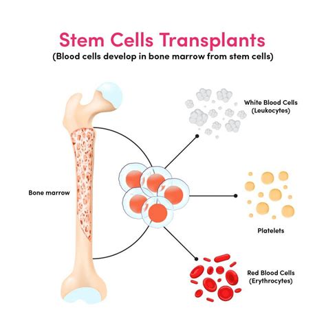 Stem Cell Facility Ms Ramaiah Memorial Hospital