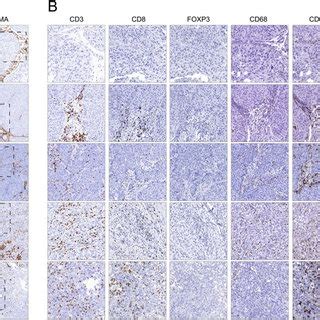 Representative images of immune cell marker staining in UC. (A)... | Download Scientific Diagram