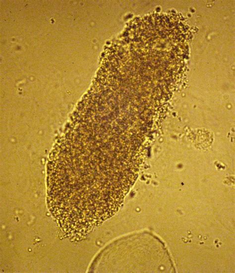 Brown Hospital Medicine On Twitter A 44 Year Old Woman Presented