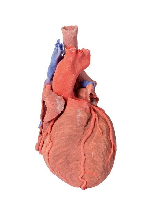 Heart and the distal trachea, carina and primary bronchi