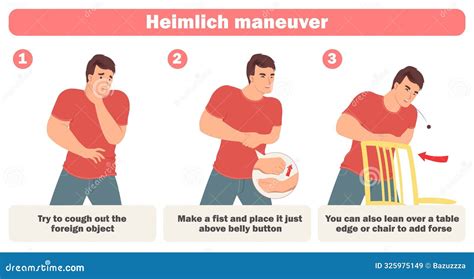 Heimlich Maneuver To Safe Own Life Due To Choking Vector Illustration ...