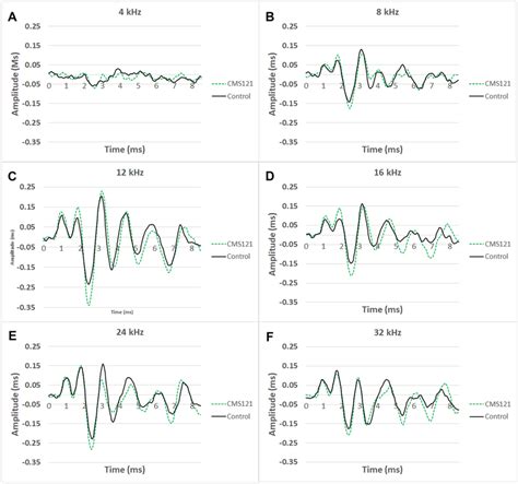 ABR Waveforms At 80 DB Averaged Across Untreated SAMP8 Mice Black