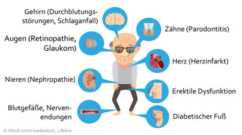 Begleit Und Folgeererkrankungen Bei Diabetes