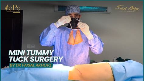 Mini Tummy Tuck Surgery Youtube