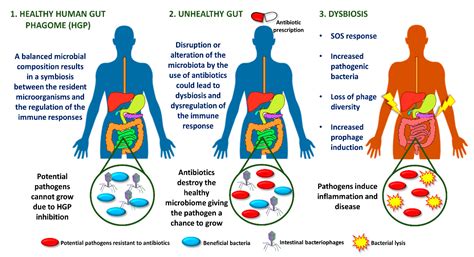 Microorganisms Free Full Text Phage Therapy In Gastrointestinal