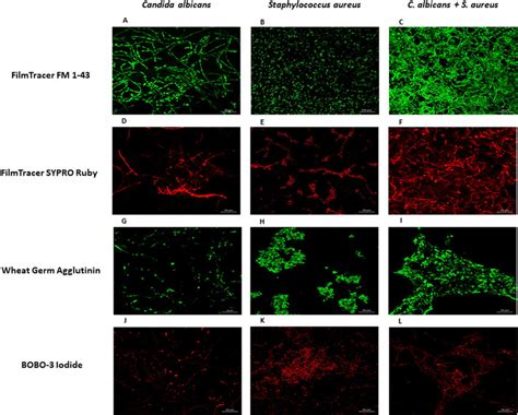 Analysis By Confocal Microscopy Of The S Aureus And C Albicans