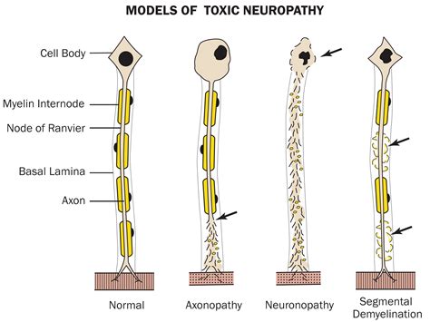 Peripheral Nerve Histology Nodes Of Ranvier