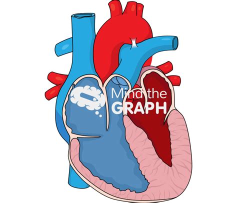 Heart Left Ventricle Hypertrophy Cut