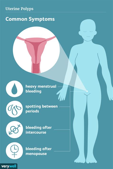 The Symptoms Of Uterine Polyps