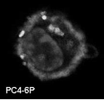 Capsule Detection By Maneval Staining Of Bacterial Smears Strains