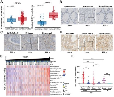 NNMT Is Overexpressed In CRC From Public Datasets And Clinical Sample