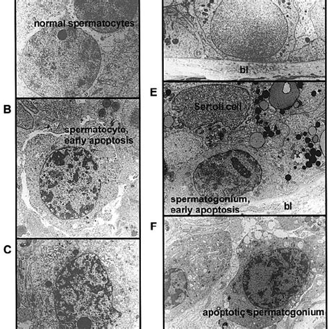 Electron Micrographs Of Cells From The Human Testis Segments Of