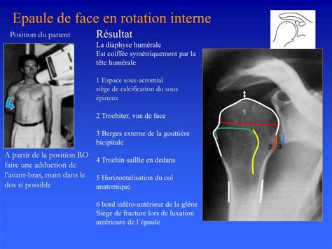 PPT ANATOMIE RADIOLOGIQUE DE LEPAULE PowerPoint Presentation Free