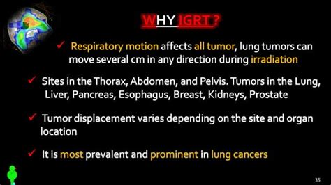 Image Guided Radiation Therapy Igrt Ppt