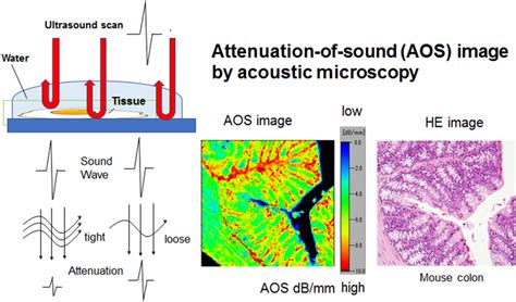 The principles of the attenuation-of-sound (AOS) image. Sound waves ...