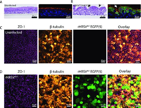 Immunohistochemistry And Indirect Immunofluorescence On Primary