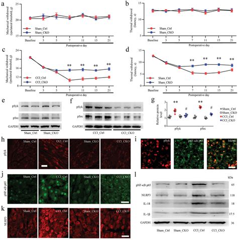 neuronal fcgammareceptor type  fcgri mediated nerve injury induced