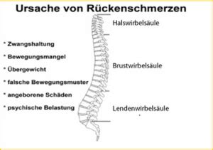 Rückenschmerzen Ursachen Was sind Auslöser von Schmerzen im Rücken