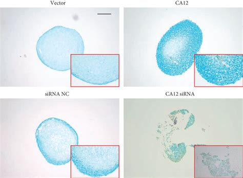 CA12 Suppressed Rat Tracheal Chondrocyte Proliferation And