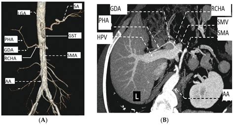 Diagnostics Free Full Text Clinical Consideration Of Anatomical