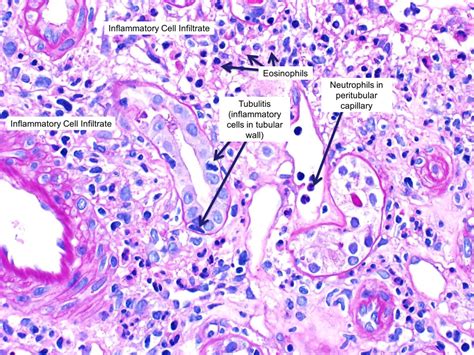 Macrophage Cell Histology