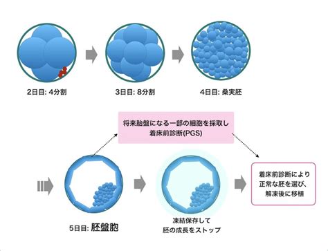 着床前診断pgt Aとは 卵子提供のいろは