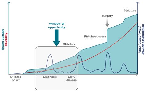 The Four Epidemiological Stages In The Global Evolution Of