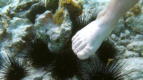 Are Sea Urchins In Croatia Poisonous The New Answer