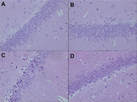 Pathological changes in the hippocampus of rats in each group on day 7 ... 