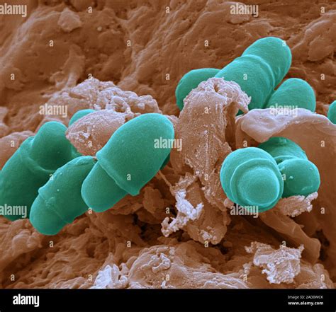 Malassezia Skin Fungus Coloured Scanning Electron Micrograph Sem Of