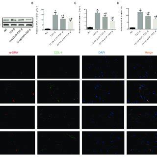 EVP Inhibited Fibroblast Activation And Reduced ECM Expression A