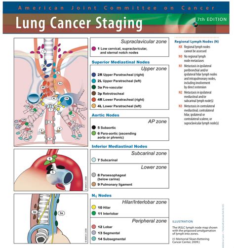 Tnm Staging Lung Cancer 8th Edition Pdf