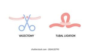 Vasectomy Near Me - Education Arenas