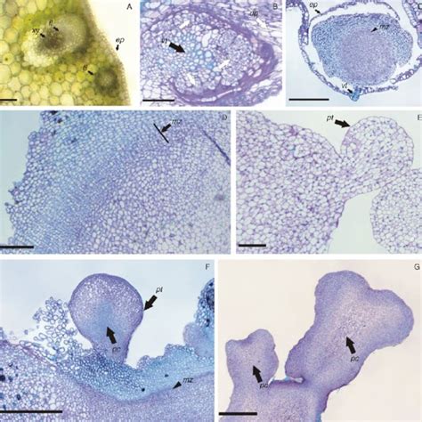 Somatic Embryogenesis And Plantlet Regeneration From Thin Cell Layers