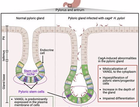 The Helicobacter Pylori CagA Oncoprotein Disrupts Wnt PCP Signaling And