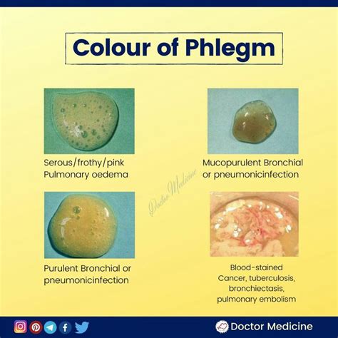 Understanding Sputum Colors