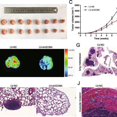 Gcma Promotes Gc Cell Migration Invasion And Growth In Vitro A B Gcma Download Scientific