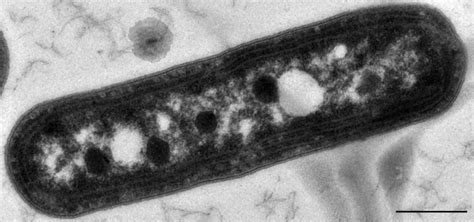 Prokaryotes Examples To Learn From - Science Trends