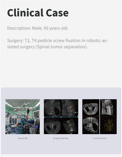 Orthopedic Robotics For Spine Surgery Surgical Robot Perlove