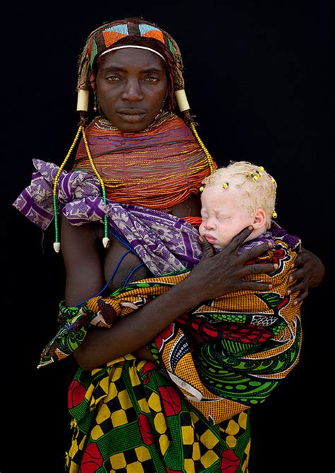 Albinism And Whiteness The Origin Of The Caucasian Grandmother Africa