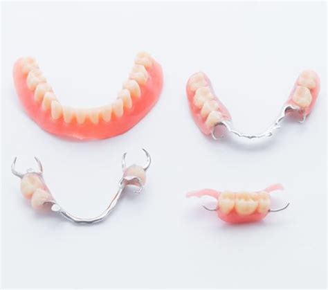 List 101 Pictures Pictures Of Partial Dentures For Back Teeth Full HD