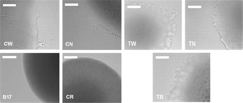 Light Micrographs Showing Representative Colony Edges After 3 Day