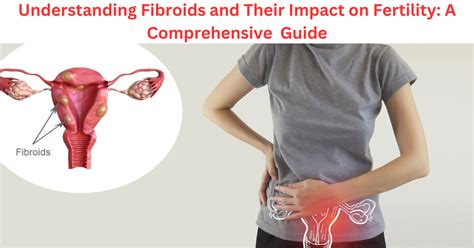 Understanding Fibroids And Their Impact On Fertility A Comprehensive