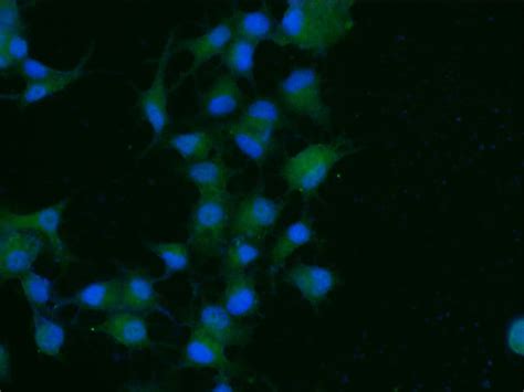 Recombinant Anti Prolactin Receptor Prl R Antibody Bsa And